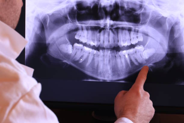 Best Emergency Dentist for Knocked-Out Tooth in Belterra, TX
