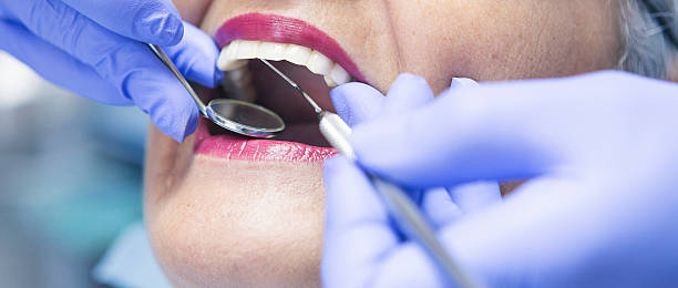 Best Broken or Cracked Tooth Emergency Dentist in Belterra, TX